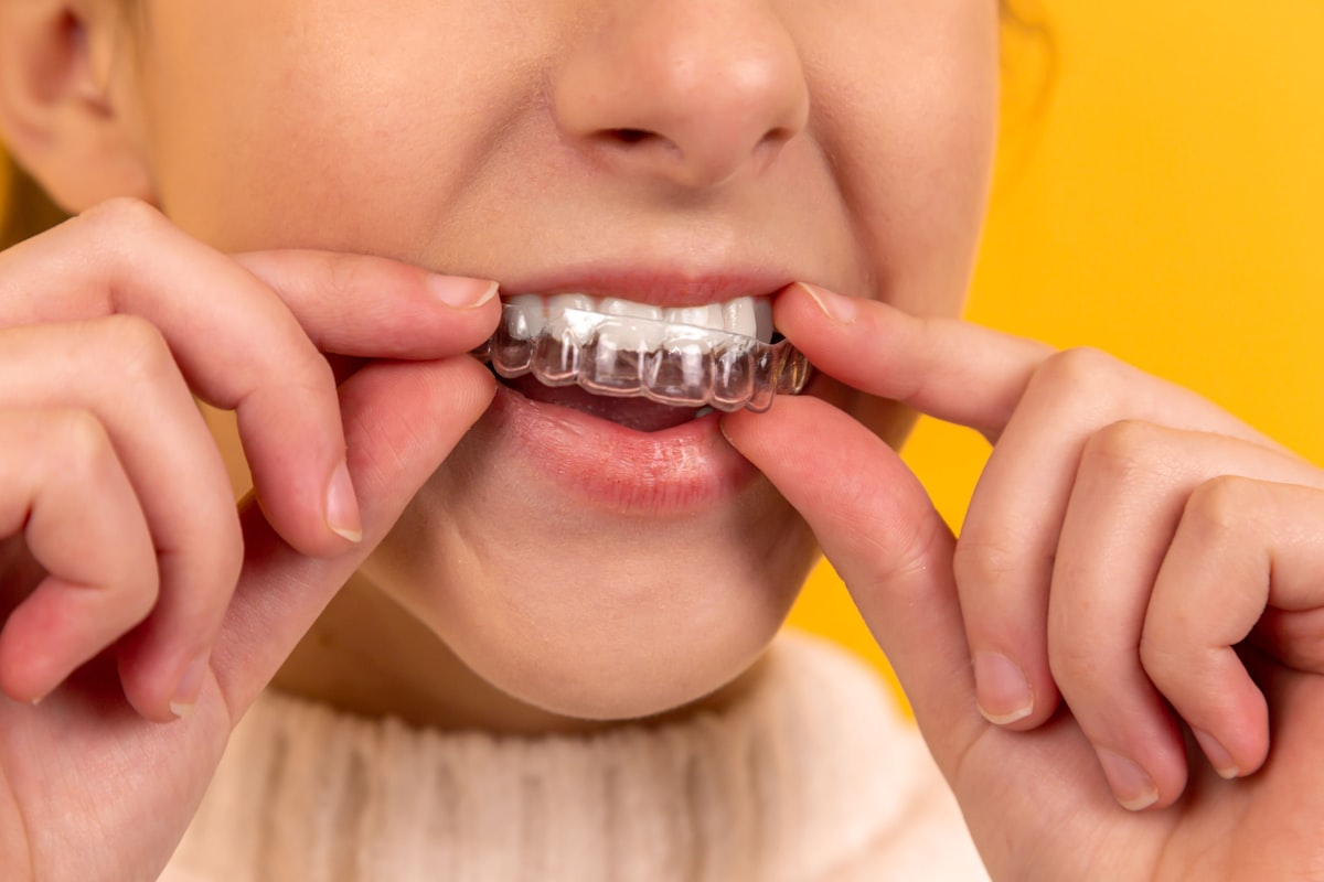 Illustrative: a bright, confident smile after care
